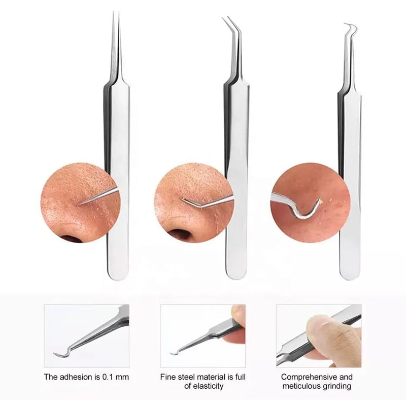 Professional Facial Blackhead Remover Tweezers